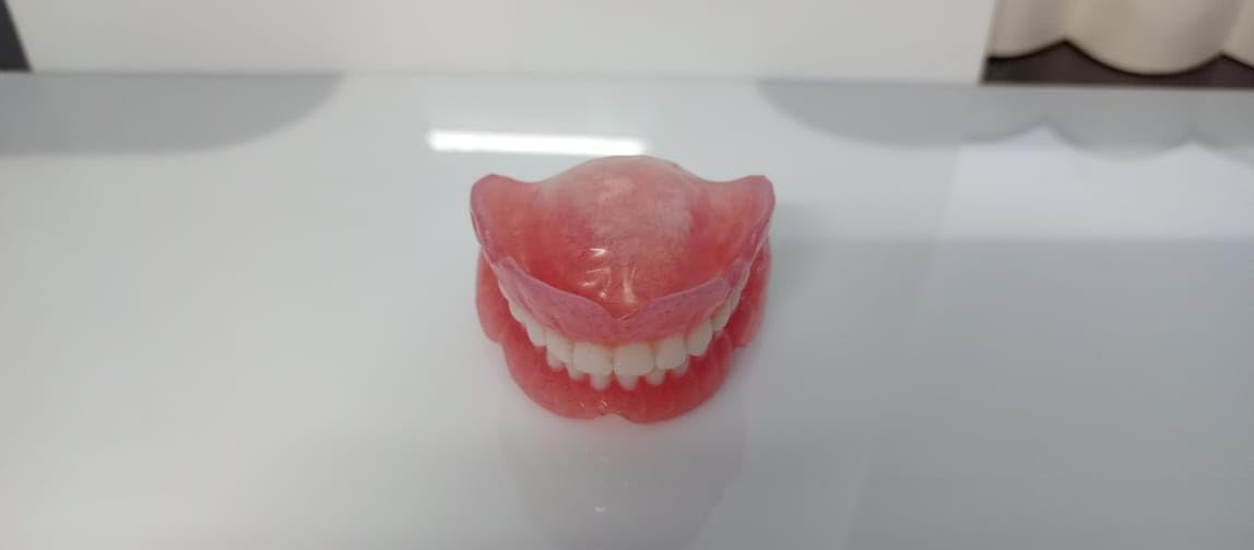 Denture full arch upper lower E584