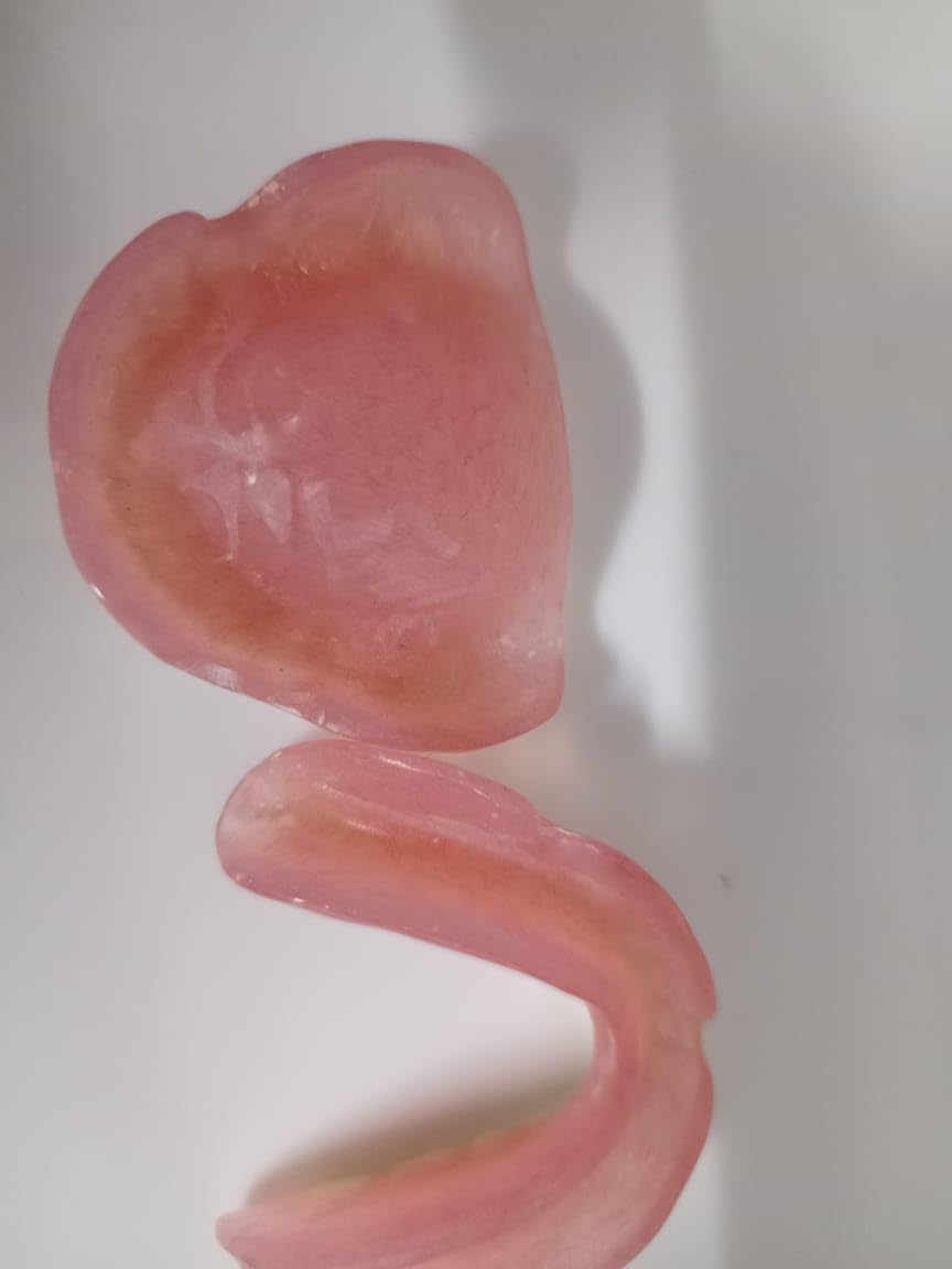 Denture full arch upper lower E584