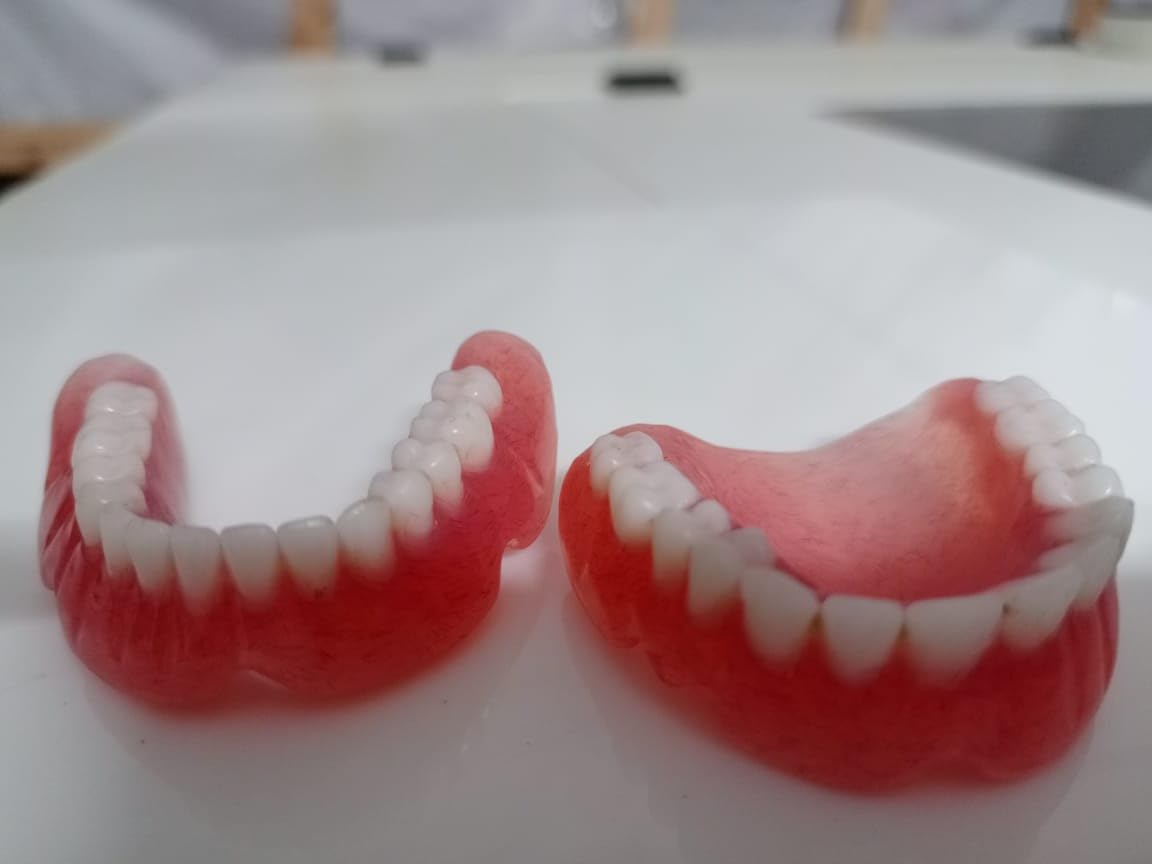 Denture full arch upper lower E584