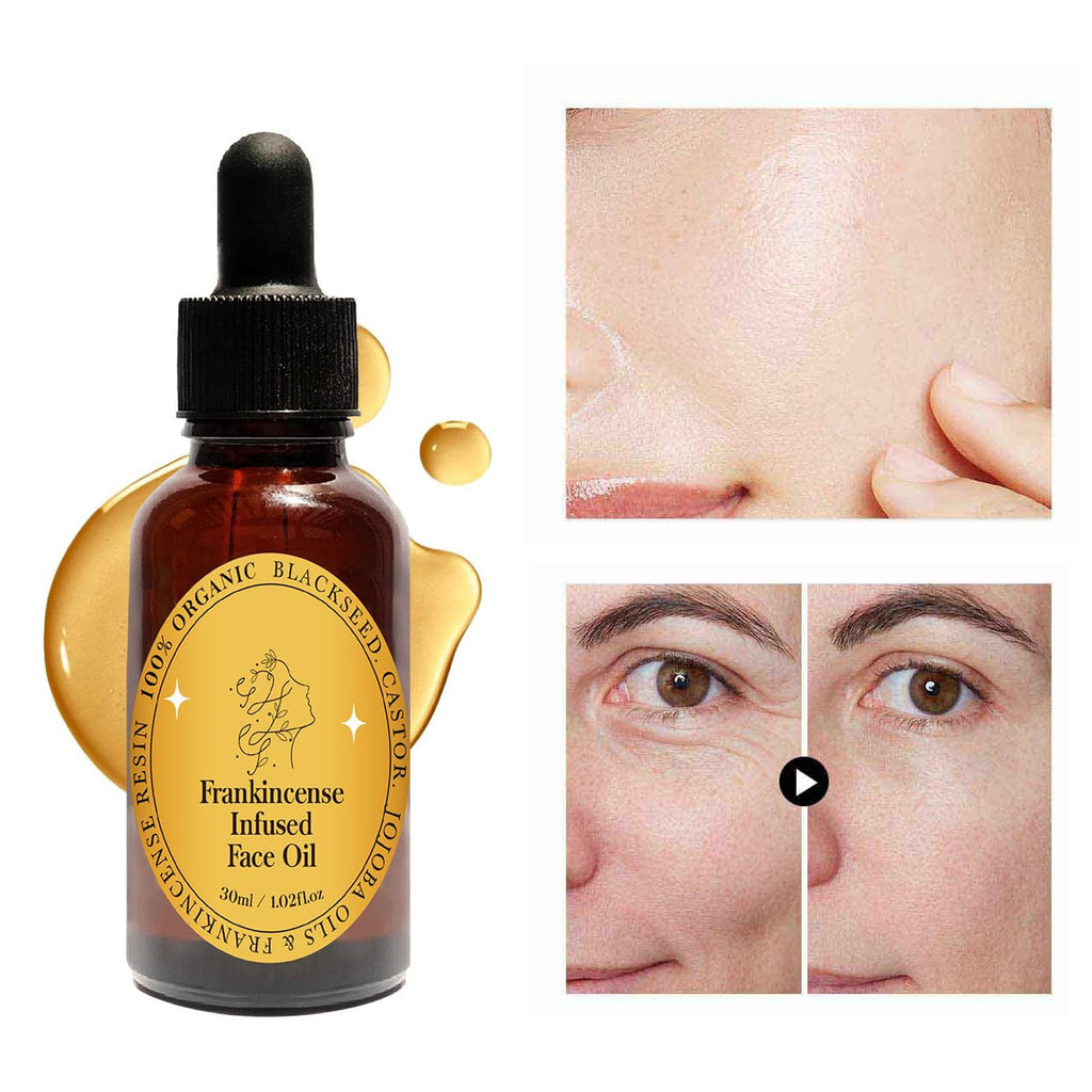 Frankincense Resin Oil Facial Serum 3PC I49170
