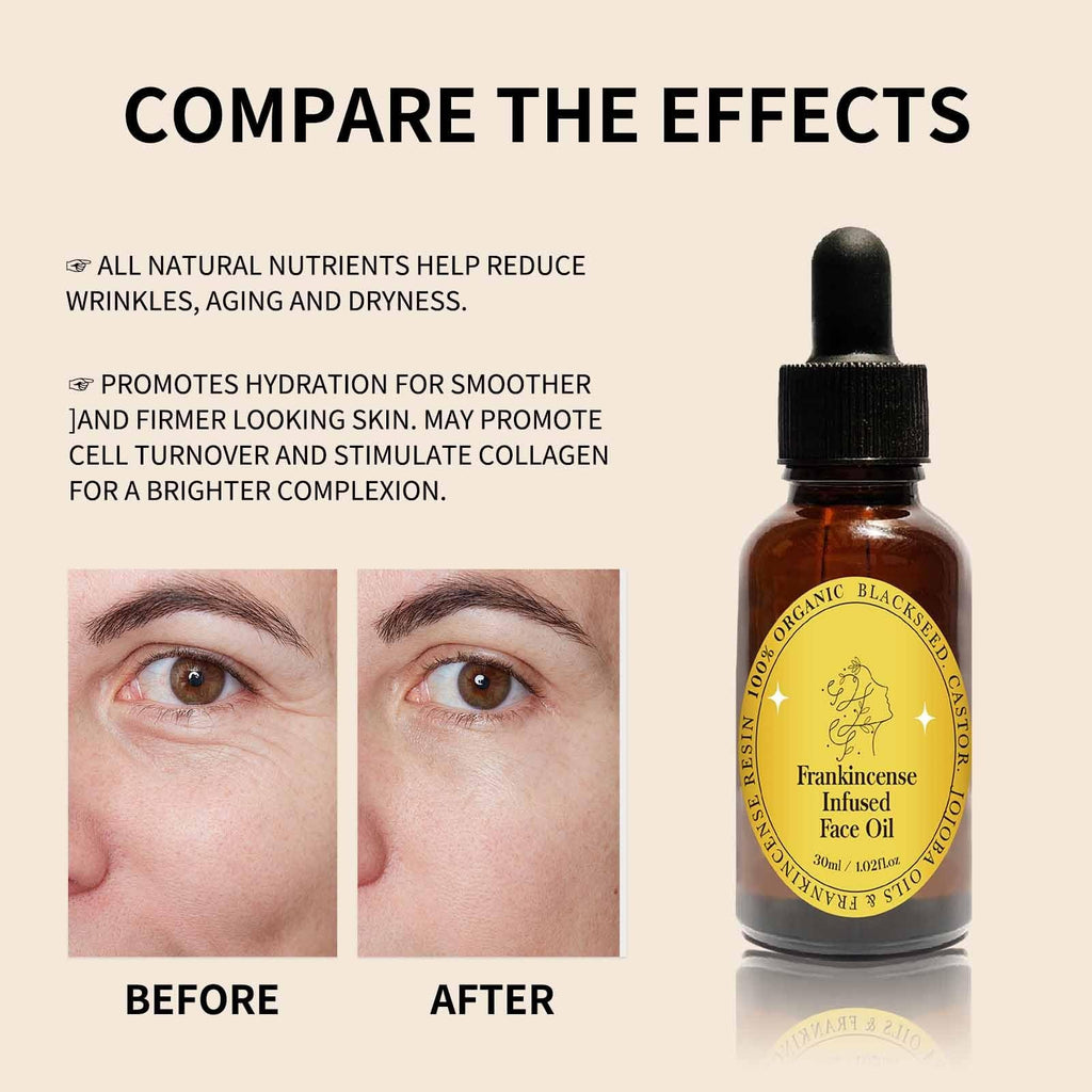 Frankincense Resin Oil Facial Serum 3PC I49170